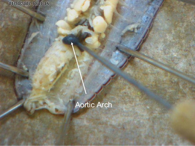 earthworm dissection aortic arches earthworm aortic arches earthworm dissection aortic arches earthworm aortic arches