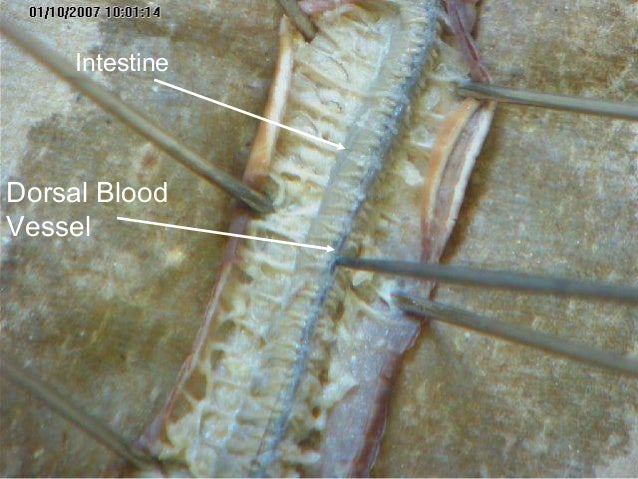 earthworm dissection ventral nerve cord earthworm dissection 001 earthworm dissection ventral nerve cord earthworm dissection 001