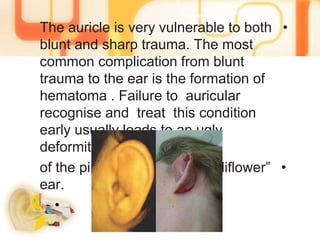 •The auricle is very vulnerable to both
blunt and sharp trauma. The most
common complication from blunt
trauma to the ear is the formation of
auricularhematoma . Failure to
recognise and treat this condition
early usually leads to an ugly
deformity
•of the pinna known as a “cauliflower”
ear.
•
 