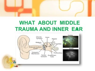 WHAT ABOUT MIDDLE
AND INNER EARTRAUMA
 