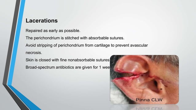 EAR TRAUMA AND FOREIGN BODY.pptx