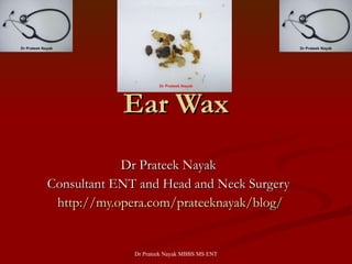 Ear Wax Dr Prateek Nayak  Consultant ENT and Head and Neck Surgery  http://my.opera.com/prateeknayak/blog/ 