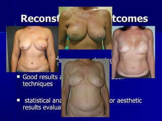 Reconstructive Outcomes Aesthetic outcomes can be considered similar Same flap tissues, same shaping Good results are possible using both techniques statistical analysis is required for aesthetic results evaluation 