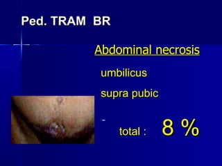 Ped. TRAM  BR  Abdominal necrosis umbilicus  supra pubic  total :  8 % 