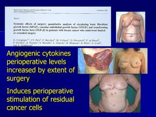   Angiogenic cytokines perioperative levels increased by extent of surgery  Induces perioperative stimulation of residual cancer cells 
