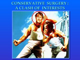 CONSERVATIVE  SURGERY : A CLASH OF  INTERESTS 