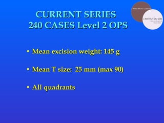 CURRENT SERIES   240 CASES Level 2 OPS Mean excision weight: 145 g Mean T size:  25 mm (max 90) All quadrants  