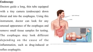 Endoscopy


Doctors guide a long, thin tube equipped
with a tiny camera (endoscope) down
throat and into the esophagus. Using this
instrument, doctor can look for any
unusual appearance of the esophagus and
remove small tissue samples for testing.
The esophagus may look different
depending on the cause of the
inflammation, such as drug-induced or
reflux esophagitis.
 