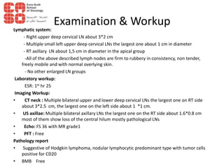 Examination & Workup
Lymphatic system:
- Right upper deep cervical LN about 3*2 cm
- Multiple small left upper deep cervical LNs the largest one about 1 cm in diameter
- RT axillary LN about 1,5 cm in diameter in the apical group
-All of the above described lymph nodes are firm to rubbery in consistency, non tender,
freely mobile and with normal overlying skin.
- No other enlarged LN groups
Laboratory workup:
ESR: 1st hr 25
Imaging Workup:
• CT neck : Multiple bilateral upper and lower deep cervical LNs the largest one on RT side
about 3*2.5 cm, the largest one on the left side about 1 *1 cm.
• US axillae: Multiple bilateral axillary LNs the largest one on the RT side about 1.6*0.8 cm
most of them show loss of the central hilum mostly pathological LNs
• Echo: FS 36 with MR grade1
• PFT : Free
Pathology report
• Suggestive of Hodgkin lymphoma, nodular lymphocytic predominant type with tumor cells
positive for CD20
• BMB Free
 