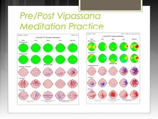 Pre/Post Vipassana 
Meditation Practice 
 