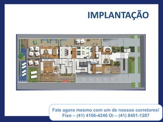 IMPLANTAÇÃO




(55) 41 8401-1287
 