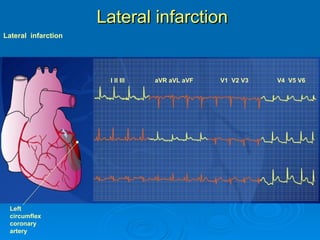 Easy to read ekg, how to read, how to representation | PPT