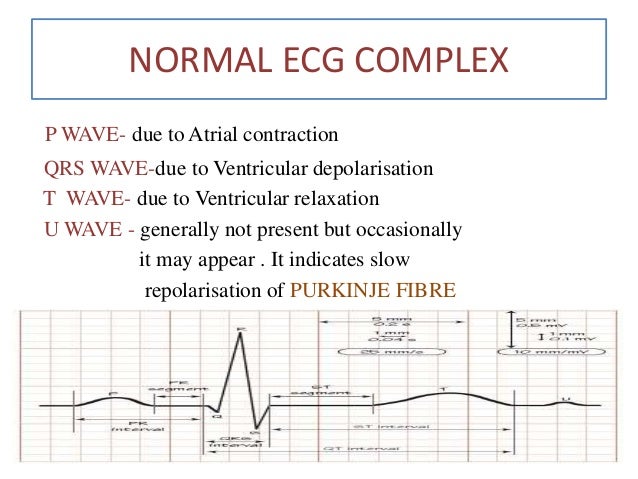 Easy Ecg Interpretation