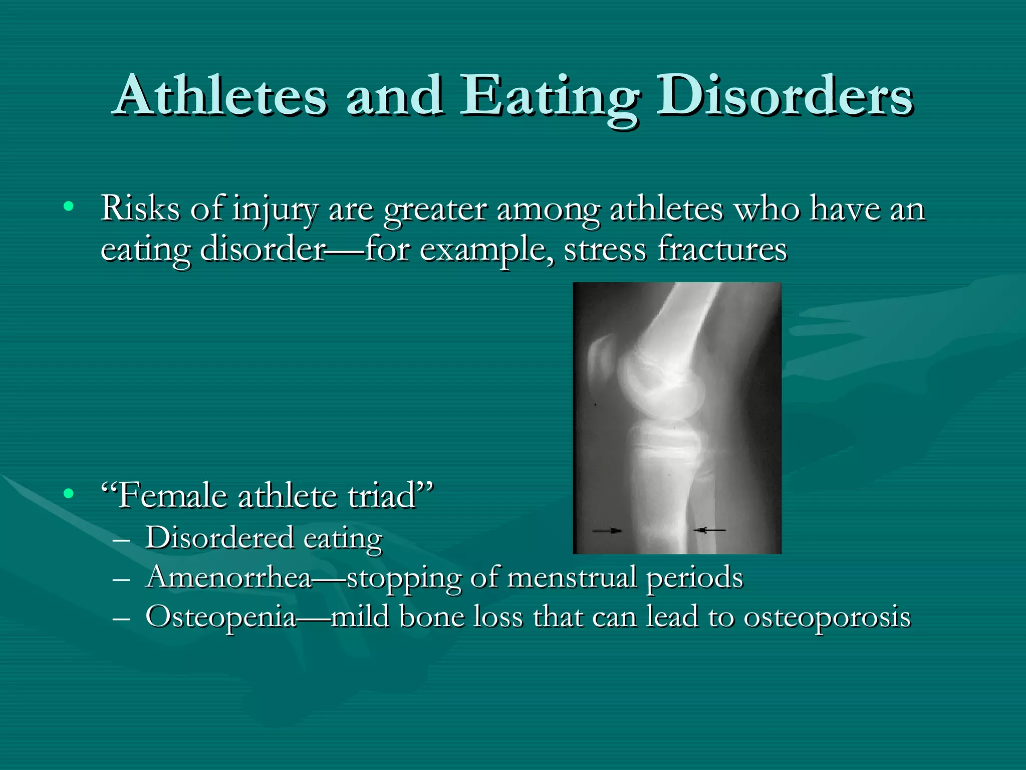 Athletes and Eating Disorders Risks of injury are greater among athletes who have an eating disorder—for example, stress fractures “ Female athlete triad” Disordered eating Amenorrhea—stopping of menstrual periods Osteopenia—mild bone loss that can lead to osteoporosis 