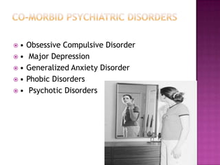 •
•
•
•

•

Obsessive Compulsive Disorder
Major Depression
Generalized Anxiety Disorder
Phobic Disorders
Psychotic Disorders

 