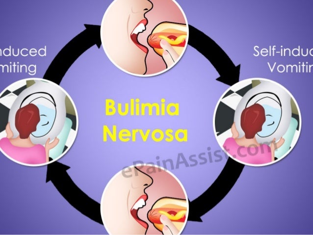 topamax dose binge eating disorder