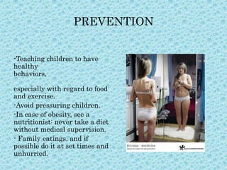 PREVENTION
-Teaching children to have
healthy
behaviors,
especially with regard to food
and exercise.
-Avoid pressuring children.
-In case of obesity, see a
nutritionist: never take a diet
without medical supervision.
- Family eatings, and if
possible do it at set times and
unhurried.

 