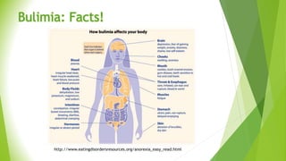 Bulimia: Facts!
http://www.eatingdisordersresources.org/anorexia_easy_read.html
 