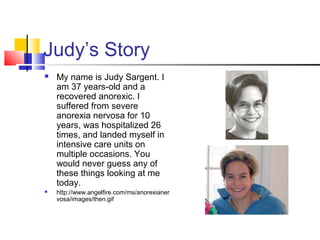 Judy’s Story
 My name is Judy Sargent. I
am 37 years-old and a
recovered anorexic. I
suffered from severe
anorexia nervosa for 10
years, was hospitalized 26
times, and landed myself in
intensive care units on
multiple occasions. You
would never guess any of
these things looking at me
today.
 http://www.angelfire.com/ms/anorexianer
vosa/images/then.gif
 