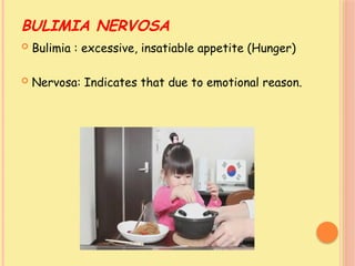 BULIMIA NERVOSA
 Bulimia : excessive, insatiable appetite (Hunger)
 Nervosa: Indicates that due to emotional reason.
 