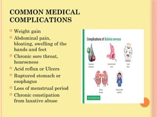 COMMON MEDICAL
COMPLICATIONS
 Weight gain
 Abdominal pain,
bloating, swelling of the
hands and feet
 Chronic sore throat,
hoarseness
 Acid reflux or Ulcers
 Ruptured stomach or
esophagus
 Loss of menstrual period
 Chronic constipation
from laxative abuse
 