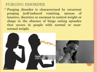 PURGING DISORDER
 Purging disorder is characterized by recurrent
purging (self-induced vomiting, misuse of
laxative, diuretics or enemas) to control weight or
shape in the absence of binge eating episodes
that occurs in people with normal or near-
normal weight.
 