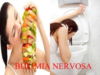 BULIMIA NERVOSA
 