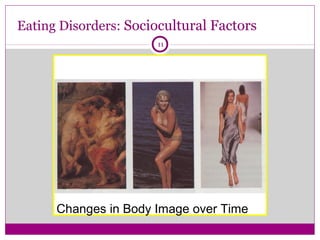 Eating Disorders: Sociocultural Factors 
11 
Changes in Body Image over Time 
 