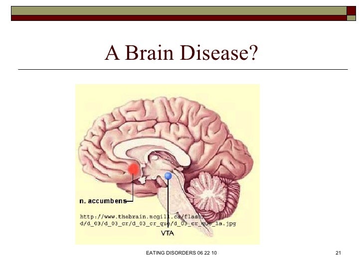 Eating Disorders - June 2012