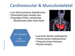 Cardiovascular & Musculoskeletal
• Low blood pressure (hypotension)
• Diminished heart muscle size
• Potentially FATAL arrhythmias
•Bradycardia (slow heart beat)
92%- osteopenia
38% -
osteoporosis
•Low bone density (osteopenia)
• Porous bones (osteoporosis)
• Frequent stress fractures
• Muscle Atrophy
 