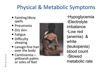 Physical & Metabolic Symptoms
 Fainting/dizzy
spells
 Pneumonia
 Dry skin
 Fatigue
 Difficulty
sleeping
 Lanugo-fine hair
over the body
 Carotinemia—
yellowish palms
or soles of feet
•Hypoglycemia
•Electrolyte
imbalance
•Low red
(anemia) &
white
(leukopenia)
blood count
•Slowed
metabolic rate
 