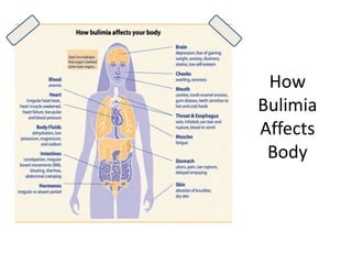 How
Bulimia
Affects
Body
 