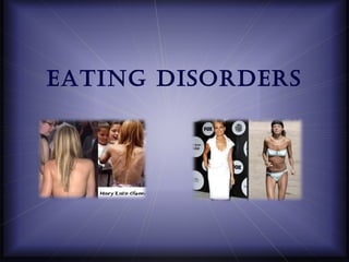 Eating DisorDErs
 