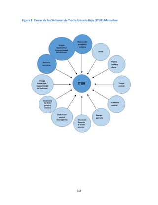 182
Figura 1: Causas de los Síntomas de Tracto Urinario Bajo (STUB) Masculinos
Estenosis
uretral
Piedra
ureteral
distal
Infección/in
flamación
de las vías
urinarias
Cuerpo
extraño
 