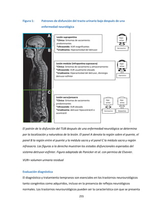255
Figura 1: Patrones de disfunción del tracto urinario bajo después de una
enfermedad neurológica
El patrón de la disfunción del TUB después de una enfermedad neurológica se determina
por la localización y naturaleza de la lesión. El panel A denota la región sobre el puente, el
panel B la región entre el puente y la médula sacra y el panel C la médula sacra y región
infrasacra. Las figuras a la derecha muestran los estados disfuncionales esperados del
sistema detrusor-esfínter. Figura adaptada de Panicker et al. con permiso de Elsevier.
VUR= volumen urinario residual
Evaluación diagnóstica
El diagnóstico y tratamiento tempranos son esenciales en los trastornos neurourológicos
tanto congénitos como adquiridos, incluso en la presencia de reflejos neurológicos
normales. Los trastornos neurourológicos pueden ser la característica con que se presenta
Lesión suprapontina
*Clínica: Síntomas de vaciamiento
predominantes
*Ultrasonido: VUR insignificantes
*Urodinamia: Hiperactividad del detrusor
Hiper
activa
Hiper
activa
Hipo
activa
Hipo
activa
Hipoactivo
Normoactivo
Normoactivo
Hiperactivo
Lesión medular (infrapontina-suprasacra)
*Clínica: Síntomas de vaciamiento y almacenamiento
*Ultrasonido: VUR usualmente elevado
*Urodinamia: Hiperactividad del detrusor, disinergia
detrusor-esfínter
Lesión sacra/presacra
*Clínica: Síntomas de vaciamiento
predominantes
*Ultrasonido: VUR elevado
*Urodinamia: detrusor hipocontráctil o
acontráctil
 