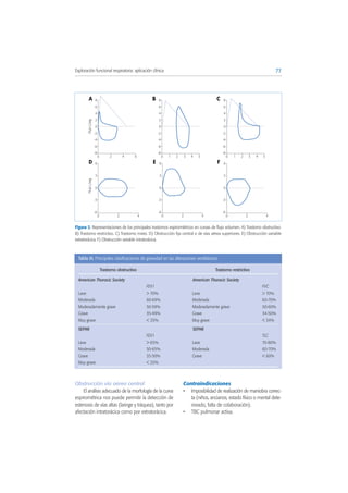 Obstrucción vía aérea central
El análisis adecuado de la morfología de la curva
espirométrica nos puede permitir la detección de
estenosis de vías altas (laringe y tráquea), tanto por
afectación intratorácica como por extratorácica.
Contraindicaciones
• Imposibilidad de realización de maniobra correc-
ta (niños, ancianos, estado físico o mental dete-
riorado, falta de colaboración).
• TBC pulmonar activa.
77Exploración funcional respiratoria: aplicación clínica
Figura 2. Representaciones de los principales trastornos espirométricos en curvas de flujo volumen. A) Trastorno obstructivo.
B) Trastorno restrictivo. C) Trastorno mixto. D) Obstrucción fija central o de vías aérea superiores. E) Obstrucción variable
extratorácica. F) Obstrucción variable intratorácica.
FlujoL/seg
-8
-6
-4
-2
0
2
4
6
8
0 2 4 6
A
-8
-6
-4
-2
0
2
4
6
8B
-8
-6
-4
-2
0
2
4
6
8C
0 3 4 521 0 3 4 521
FlujoL/seg
-6
-3
0
3
6
0 2 4
D
-6
-3
0
3
6
0 2 4
E
-6
-3
0
3
6
0 2 4
F
Trastorno obstructivo Trastorno restrictivo
American Thoracic Society American Thoracic Society
FEV1 FVC
Leve > 70% Leve > 70%
Moderada 60-69% Moderada 60-70%
Moderadamente grave 50-59% Moderadamente grave 50-60%
Grave 35-49% Grave 34-50%
Muy grave < 35% Muy grave < 34%
SEPAR SEPAR
FEV1 TLC
Leve > 65% Leve 70-80%
Moderada 50-65% Moderada 60-70%
Grave 35-50% Grave < 60%
Muy grave < 35%
Tabla III. Principales clasificaciones de gravedad en las alteraciones ventilatorias
 