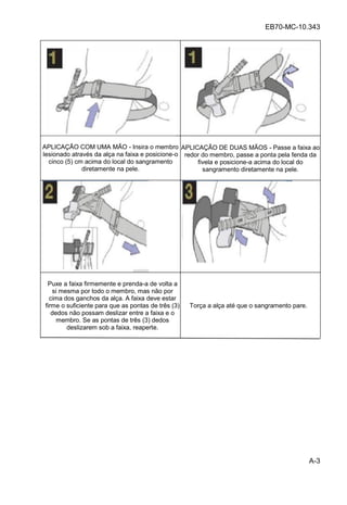 EB70-MC-10.343
A-3
APLICAÇÃO COM UMA MÃO - Insira o membro
lesionado através da alça na faixa e posicione-o
cinco (5) cm acima do local do sangramento
diretamente na pele.
APLICAÇÃO DE DUAS MÃOS - Passe a faixa ao
redor do membro, passe a ponta pela fenda da
fivela e posicione-a acima do local do
sangramento diretamente na pele.
Puxe a faixa firmemente e prenda-a de volta a
si mesma por todo o membro, mas não por
cima dos ganchos da alça. A faixa deve estar
firme o suficiente para que as pontas de três (3)
dedos não possam deslizar entre a faixa e o
membro. Se as pontas de três (3) dedos
deslizarem sob a faixa, reaperte.
Torça a alça até que o sangramento pare.
 
