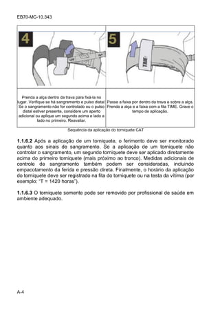 EB70-MC-10.343
A-4
Prenda a alça dentro da trava para fixá-la no
lugar. Verifique se há sangramento e pulso distal.
Se o sangramento não for controlado ou o pulso
distal estiver presente, considere um aperto
adicional ou aplique um segundo acima e lado a
lado no primeiro. Reavaliar.
Passe a faixa por dentro da trava e sobre a alça.
Prenda a alça e a faixa com a fita TIME. Grave o
tempo de aplicação.
Sequência da aplicação do torniquete CAT
1.1.6.2 Após a aplicação de um torniquete, o ferimento deve ser monitorado
quanto aos sinais de sangramento. Se a aplicação de um torniquete não
controlar o sangramento, um segundo torniquete deve ser aplicado diretamente
acima do primeiro torniquete (mais próximo ao tronco). Medidas adicionais de
controle de sangramento também podem ser consideradas, incluindo
empacotamento da ferida e pressão direta. Finalmente, o horário da aplicação
do torniquete deve ser registrado na fita do torniquete ou na testa da vítima (por
e em lo: T = 1420 ho a ).
1.1.6.3 O torniquete somente pode ser removido por profissional de saúde em
ambiente adequado.
 