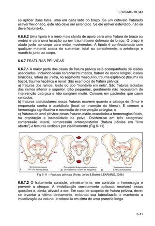 EB70-MC-10.343
6-11
se aplicar duas talas, uma em cada lado do braço. Se um cotovelo fraturado
estiver flexionado, este não deve ser estendido. Se ele estiver estendido, não se
deve flexioná-lo.
6.6.6.2 Uma tipoia é o meio mais rápido de apoio para uma fratura de braço ou
ombro e para uma luxação ou um traumatismo doloroso do braço. O braço é
atado junto ao corpo para evitar movimentos. A tipoia é confeccionada com
qualquer material capaz de sustentar, total ou parcialmente, o antebraço e
mantê-lo junto ao corpo.
6.6.7 FRATURAS PÉLVICAS
6.6.7.1 A maior parte dos casos de fratura pélvica está acompanhada de lesões
associadas, incluindo lesão cerebral traumática, fratura de ossos longos, lesões
torácicas, rotura de uretra, no segmento masculino, trauma esplênico (trauma no
baço), trauma hepático e renal. São exemplos de fratura pélvica:
a) f a a do amo : le o do i o mon a ia em ela . S o f a a i olada
dos ramos inferior e superior. São pequenas, geralmente não necessitam de
intervenção cirúrgica e não sangram muito. Comuns em pacientes que caem
sentados;
b) fraturas acetabulares: essas fraturas ocorrem quando a cabeça do fêmur é
empurrada contra o acetábulo (local de inserção do fêmur). É comum a
hemorragia significativa e necessita de intervenção cirúrgica; e
c) fraturas do anel pélvico: essas fraturas estão associadas a hemorragias fatais,
há crepitação e instabilidade da pelve. Dividem-se em três categorias:
compressão lateral, compre o an e o o e io (f a a l ica em li o
abe o ) e f a a e icai o ci alhamen o (Fig 6-11).
Fig 6-11 Fraturas pélvicas (Fonte: Jones & Bartlett LEARNING, 2016.)
6.6.7.2 O tratamento consiste, primeiramente, em controlar a hemorragia e
prevenir o choque. A imobilização corretamente aplicada resolverá essas
questões e, ainda, aliviará a dor. Em caso de suspeita de fratura pélvica, deve-
se levantar a vítima diretamente, evitando sua lateralizarão e mantendo a
imobilização da coluna, e colocá-la em cima de uma prancha longa.
 