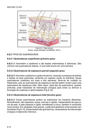 EB70-MC-10.343
6-14
Fig 6-12 Pele normal
(Fonte: Jones & Bartlett LEARNING, 2016.)
6.8.2 TIPOS DE QUEIMADURAS
6.8.2.1 Queimaduras superficiais (primeiro grau)
6.8.2.1.1 Acometem a epiderme e são lesões eritematosas e dolorosas. São
comuns nas queimaduras solares. A cura total ocorre em uma semana.
6.8.2.2 Queimaduras de espessura parcial (segundo grau)
6.8.2.2.1 Acomete a epiderme e partes da derme, havendo a presença de bolhas
e lesões na área queimada, contendo um aspecto úmido ou brilhante. Essas
queimaduras cicatrizam em duas a três semanas. Deve-se ter cuidado no
tratamento, pois as queimaduras de espessura parcial podem evoluir para uma
queimadura de espessura total. Além disso, esse tipo de queimadura, quando
profunda, pode necessitar de intervenção cirúrgica para evitar ou diminuir a
formação de cicatrizes e deformidades (Fig 6-13).
6.8.2.3 Queimaduras de espessura total (terceiro grau)
6.8.2.3.1 Essas queimaduras podem se exteriorizar de maneiras diferentes.
Normalmente, são espessas, secas, brancas e rígidas, independente de raça ou
cor da pele. A pele espessa e rígida, semelhante a couro, também é conhecida
como escara. Em situações mais graves, a pele terá aparência chamuscada com
trombose (Fig 6-14). Essas lesões são gravíssimas, necessitando de intervenção
cirúrgica e tratamento intensivo.
 