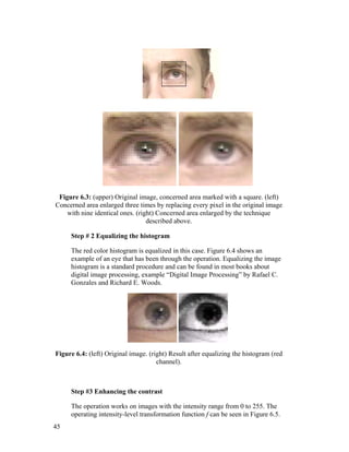 Figure 6.3: (upper) Original image, concerned area marked with a square. (left)
Concerned area enlarged three times by replacing every pixel in the original image
with nine identical ones. (right) Concerned area enlarged by the technique
described above.
Step # 2 Equalizing the histogram
The red color histogram is equalized in this case. Figure 6.4 shows an
example of an eye that has been through the operation. Equalizing the image
histogram is a standard procedure and can be found in most books about
digital image processing, example “Digital Image Processing” by Rafael C.
Gonzales and Richard E. Woods.
Figure 6.4: (left) Original image. (right) Result after equalizing the histogram (red
channel).
Step #3 Enhancing the contrast
The operation works on images with the intensity range from 0 to 255. The
operating intensity-level transformation function f can be seen in Figure 6.5.
45
 