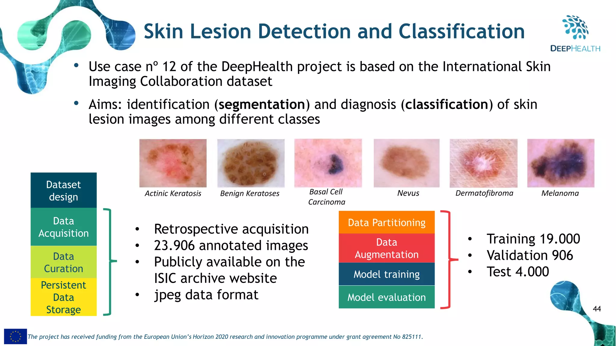 44
The project has received funding from the European Union’s Horizon 2020 research and innovation programme under grant agreement No 825111.
Skin Lesion Detection and Classification
• Use case nº 12 of the DeepHealth project is based on the International Skin
Imaging Collaboration dataset
• Aims: identification (segmentation) and diagnosis (classification) of skin
lesion images among different classes
Dataset
design
Data
Acquisition
Data
Curation
Persistent
Data
Storage
• Retrospective acquisition
• 23.906 annotated images
• Publicly available on the
ISIC archive website
• jpeg data format
Actinic Keratosis Dermatofibroma MelanomaNevusBenign Keratoses Basal Cell
Carcinoma
Data Partitioning
• Training 19.000
• Validation 906
• Test 4.000
Data
Augmentation
Model training
Model evaluation
 