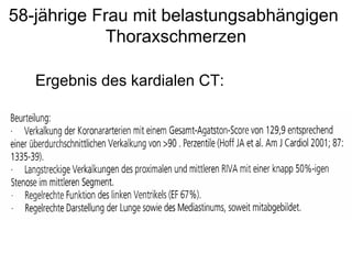 58-jährige Frau mit belastungsabhängigen
Thoraxschmerzen
Ergebnis des kardialen CT:

 