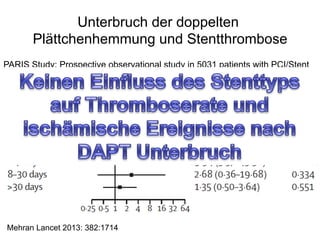 Unterbruch der doppelten
Plättchenhemmung und Stentthrombose
PARIS Study: Prospective observational study in 5031 patients with PCI/Stent

Mehran Lancet 2013: 382:1714

 