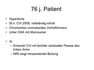 76 j. Patient
• 
• 
• 
• 

Hypertonie
St.n. CVI 2008, vollständig erholt
Chronisches normokardes Vorhoflimmern
Unter OAK mit Marcoumar

•  JL:
–  Erneuter CVI mit leichter residueller Parese des
linken Arms
–  MRI zeigt intrazerebrale Blutung

 