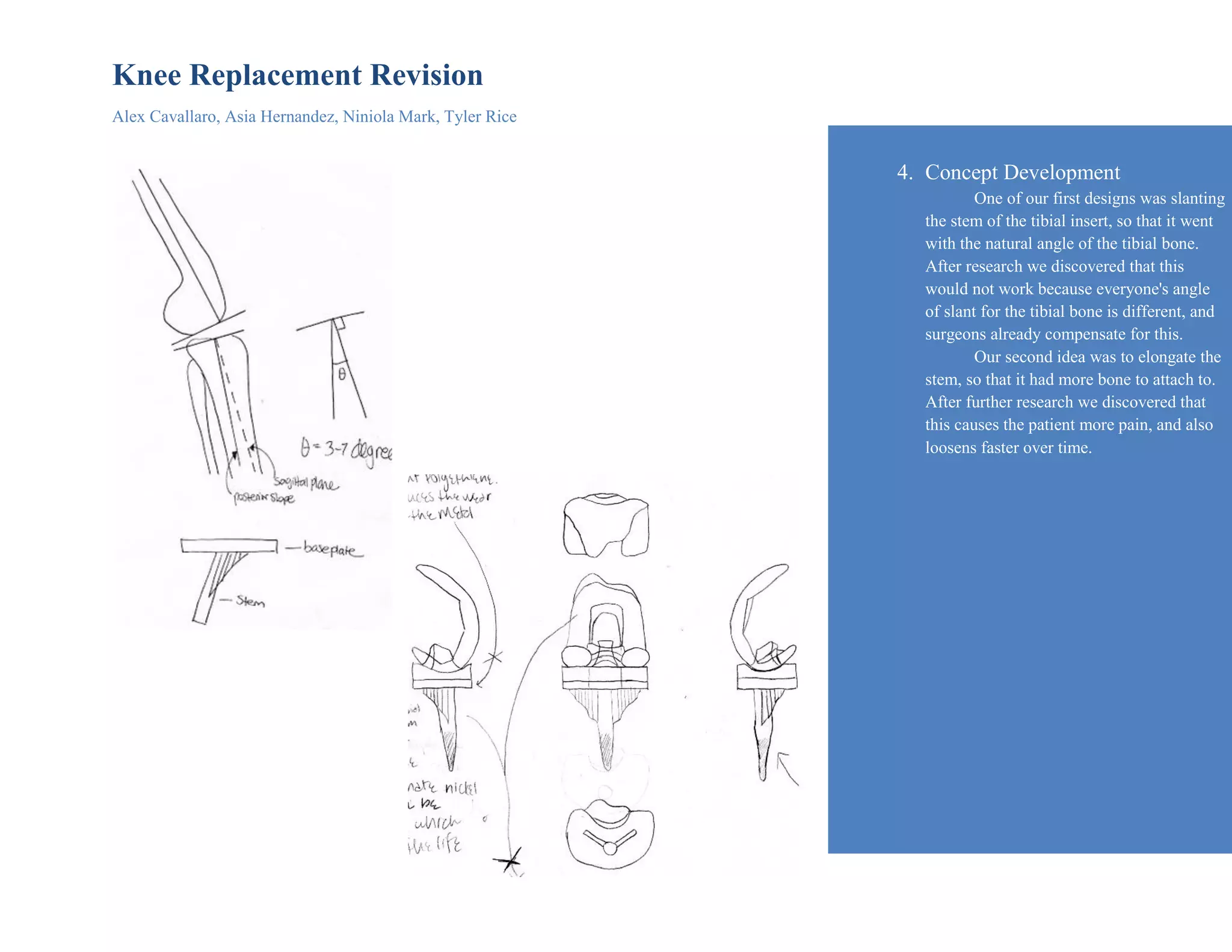 Knee Replacement Revision
Alex Cavallaro, Asia Hernandez, Niniola Mark, Tyler Rice
4. Concept Development
One of our first designs was slanting
the stem of the tibial insert, so that it went
with the natural angle of the tibial bone.
After research we discovered that this
would not work because everyone's angle
of slant for the tibial bone is different, and
surgeons already compensate for this.
Our second idea was to elongate the
stem, so that it had more bone to attach to.
After further research we discovered that
this causes the patient more pain, and also
loosens faster over time.
 