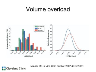 Volume overload
Maurer MS. J. Am. Coll. Cardiol. 2007;49;972-981
 