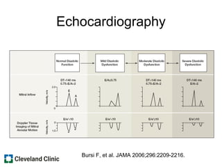 Echocardiography
Bursi F, et al. JAMA 2006;296:2209-2216.
 