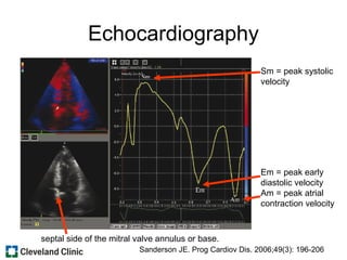 Echocardiography
Sm = peak systolic
velocity
septal side of the mitral valve annulus or base.
Em = peak early
diastolic velocity
Am = peak atrial
contraction velocity
Sanderson JE. Prog Cardiov Dis. 2006;49(3): 196-206
 