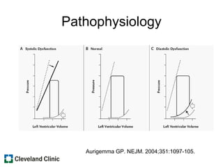 Pathophysiology
Aurigemma GP. NEJM. 2004;351:1097-105.
 